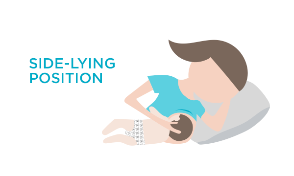 Side-lying Position