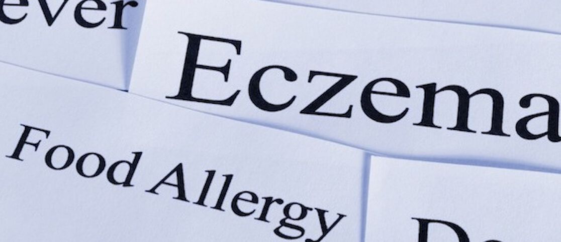 An Honest Discussion About Food Allergies & Sensitivities