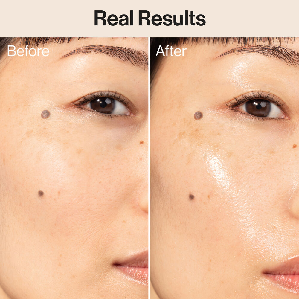 Hydrogel Cream